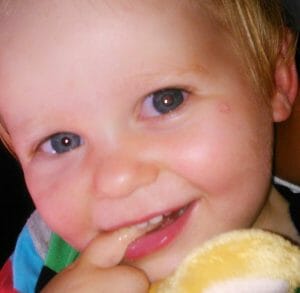 Childhood Eye Cancer Trust - Real Life Story