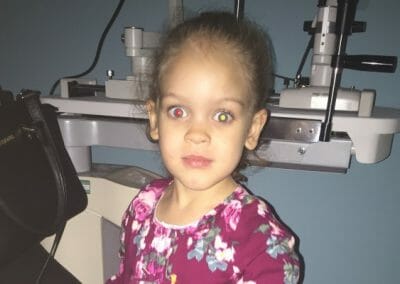 CHECT Photo - example of white eye in a photo