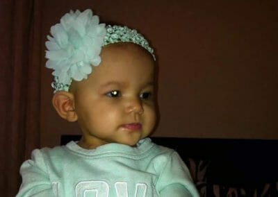 CHECT Photo - example of white eye in a photo