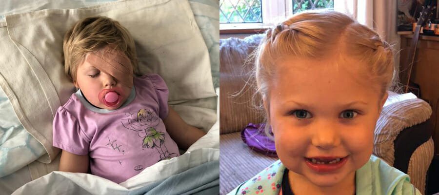 ‘Pirate game revealed my toddler’s eye cancer’