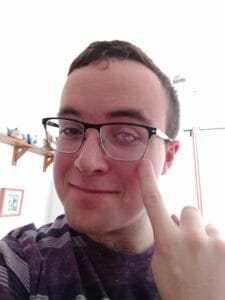 Dominic Bielby showing his new college crest artificial eye