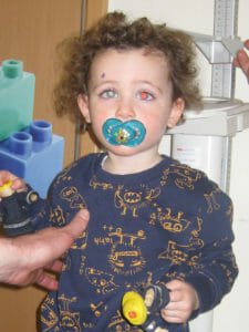 Oliver Rushton with a white glow in his right eye.