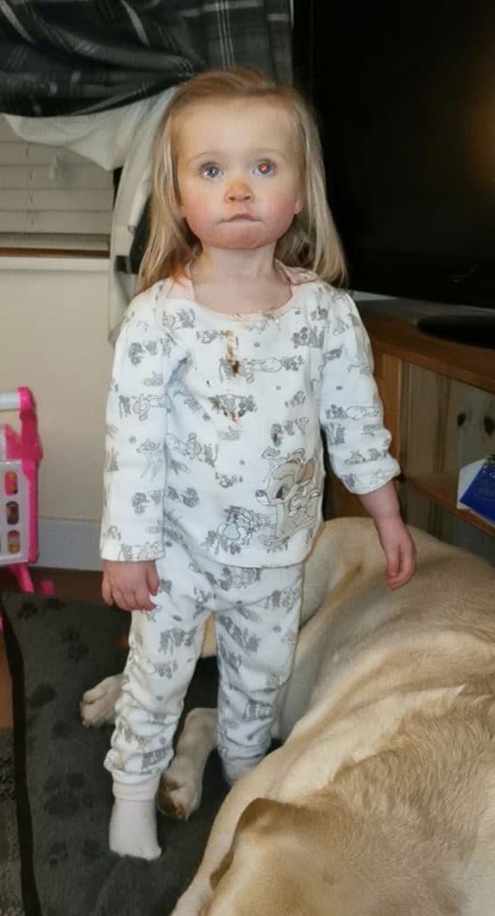 Evie Wedderburn with absence of red eye