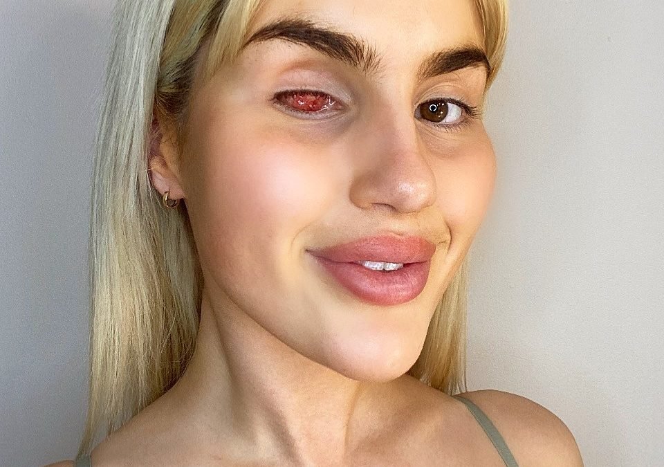 Love Your Eyes: Olivia’s Story