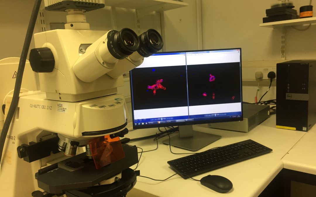 New exciting retinoblastoma research