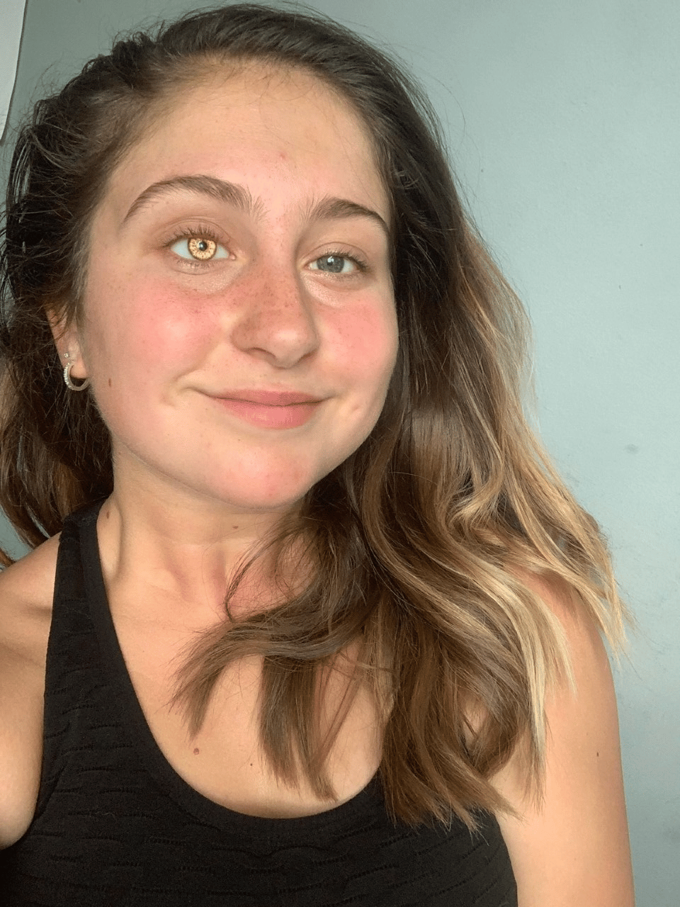 Megan smiling with her golden artificial eye