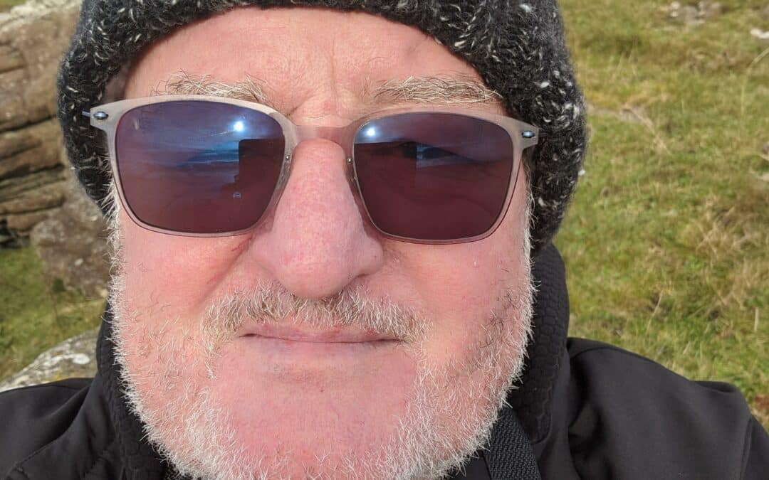 The Ocularist…Continued!