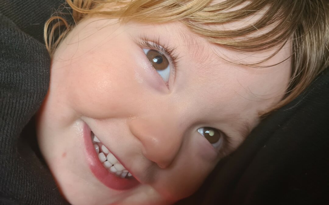 “I thought my daughter had ice in her eye, but it was retinoblastoma – eye cancer” 