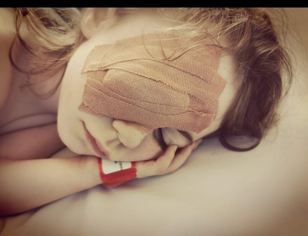 Bonnie with a bandage over her enucleated eye