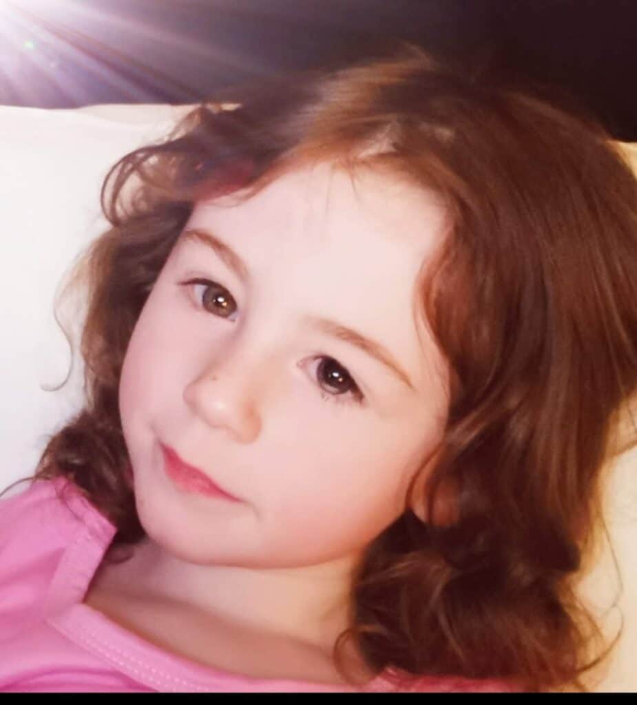 Bonnie had a milky build up in her eye