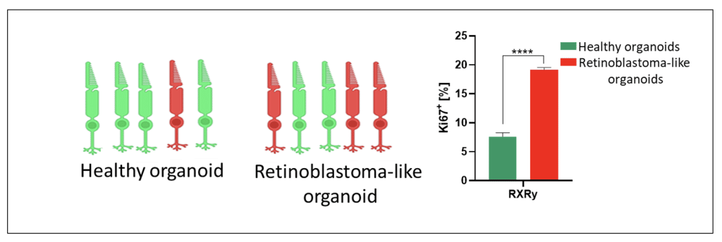 Graph shows healthy organoid compared to a retinoblastoma-like organoid