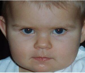 The photo shows the face of a baby