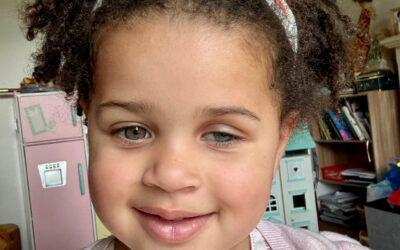 “My daughter’s eye cancer was mistaken for eczema” 