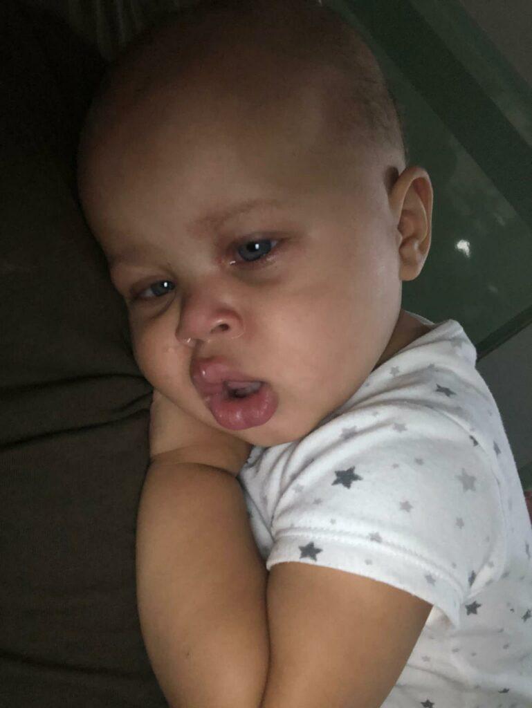 Amelia looking poorly