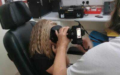 Frankie’s artificial eye fitting