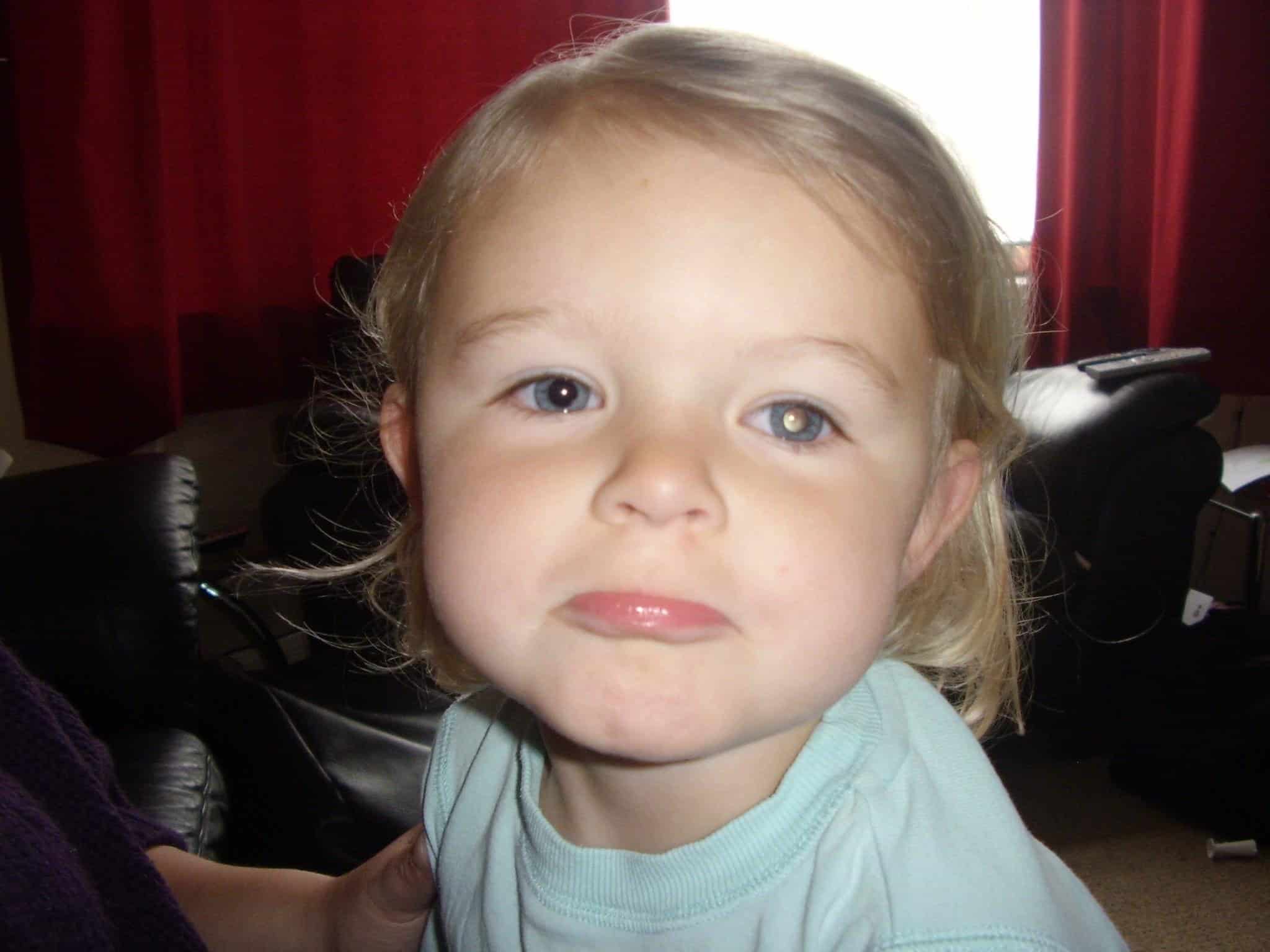 RS7204_Image white glow in eye