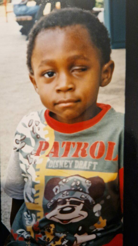 Michael as a boy without his eye in