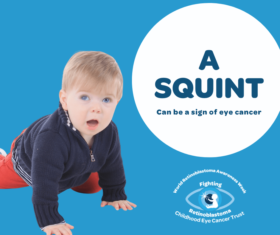 4 text reads 'a squint can be a sign of childhood eye cancer'