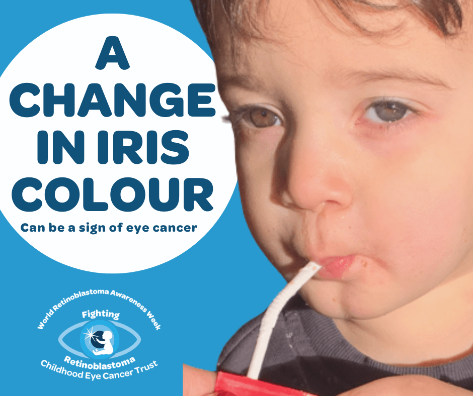 6 text reads a change in iris colour can be a sign of childhood eye cancer