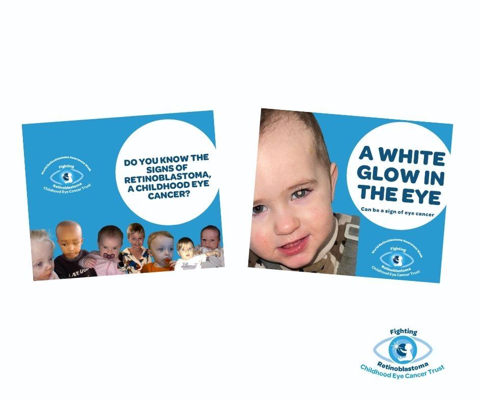 etinoblastoma eye cancer posters The image shows two photos from our social media campaign
