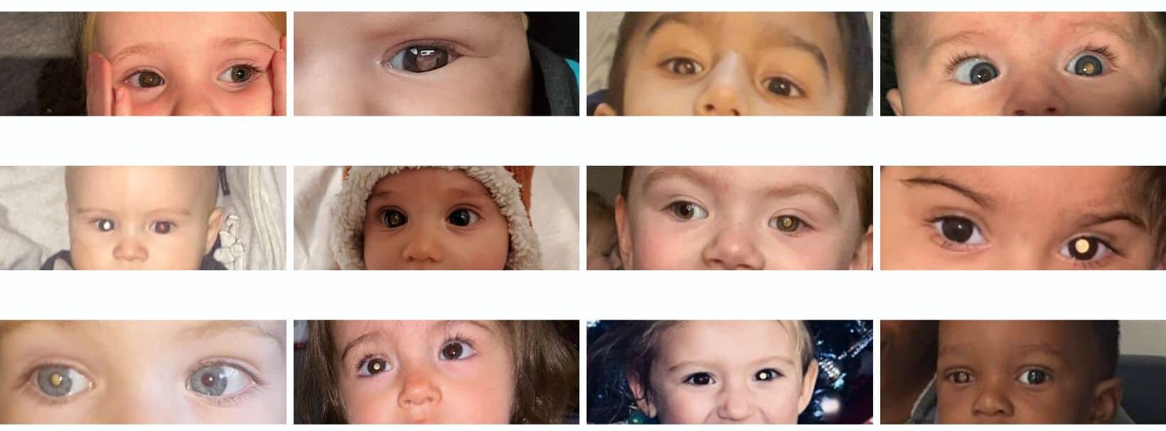 new summer collection photos showing white glow in eye