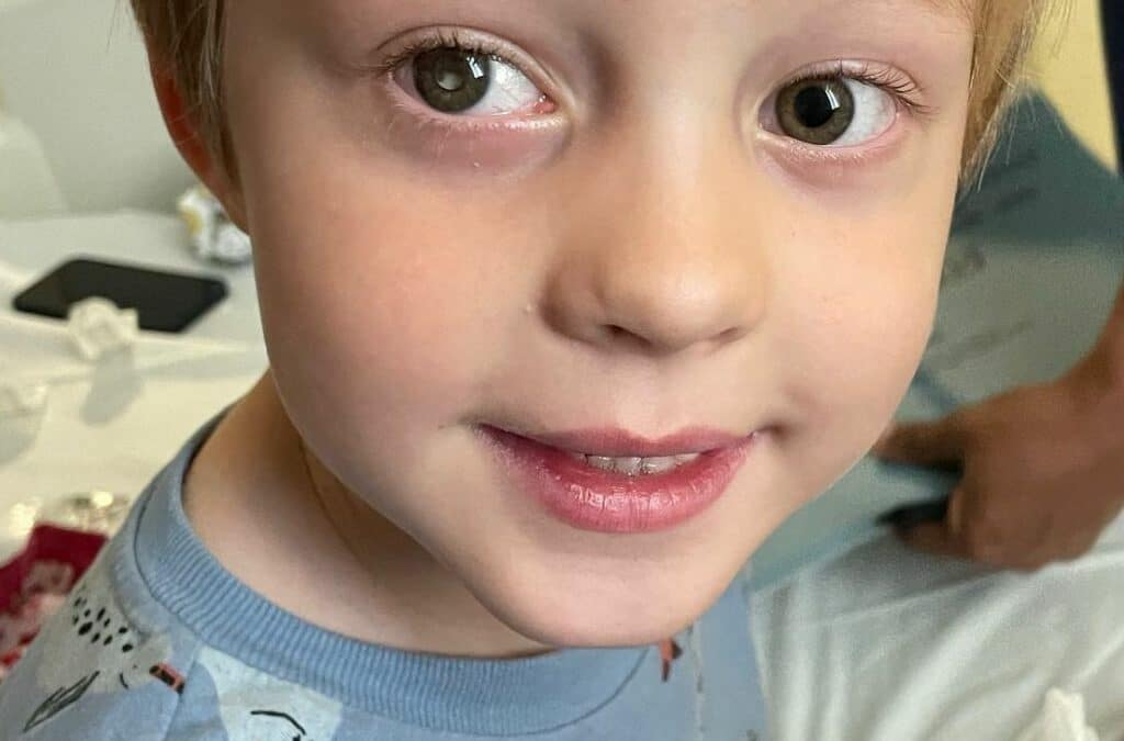 “We spotted my son’s cancer in his eye as he played with toys”