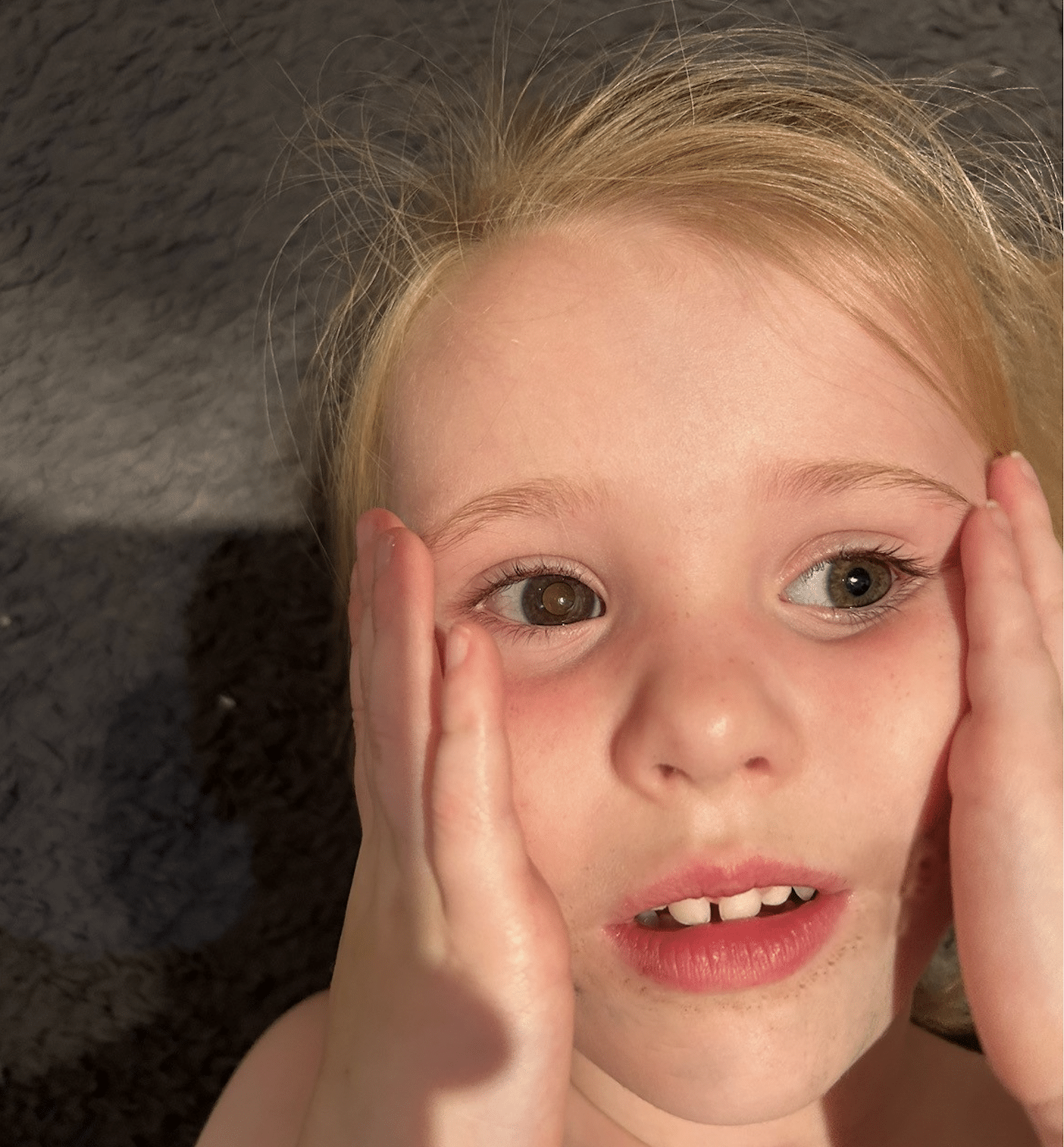 Screenshot 2024-06-25 at 12.20.20 A little girl has her hands on her face. She has a white glow in one eye