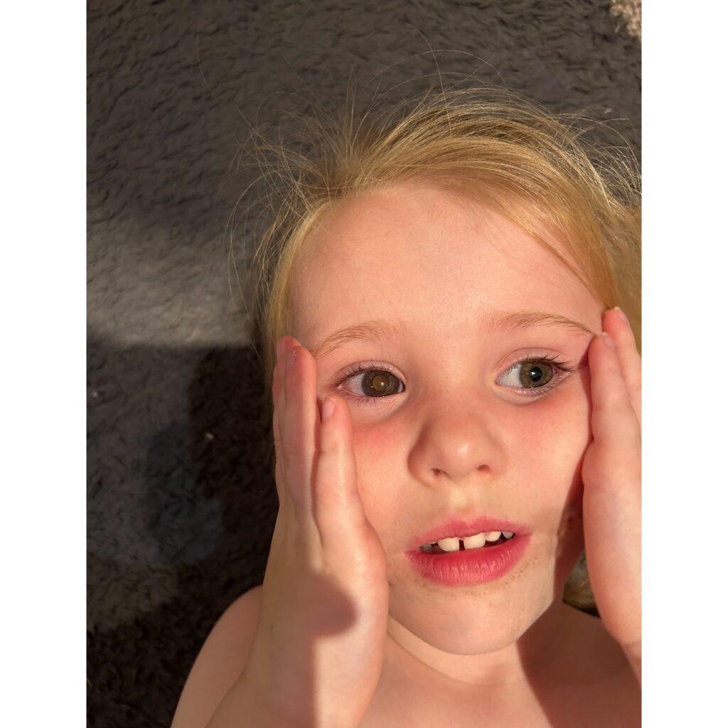 Esmae had a glow in one eye