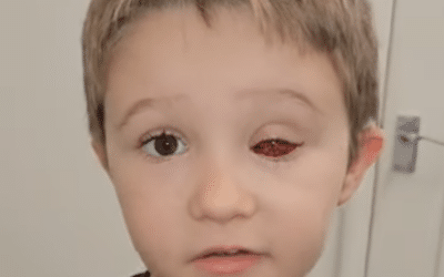 Harry’s retinoblastoma awareness video!