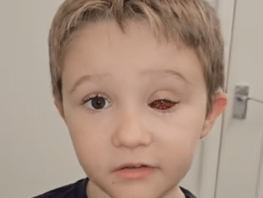 Harry’s retinoblastoma awareness video!