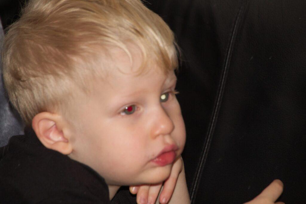  Thomas has a white glow in one eye and a red eye in the other